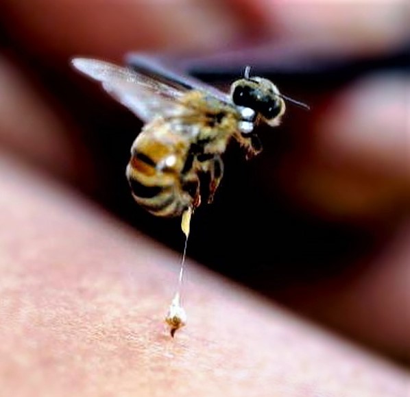 Piqure abeille therapie
